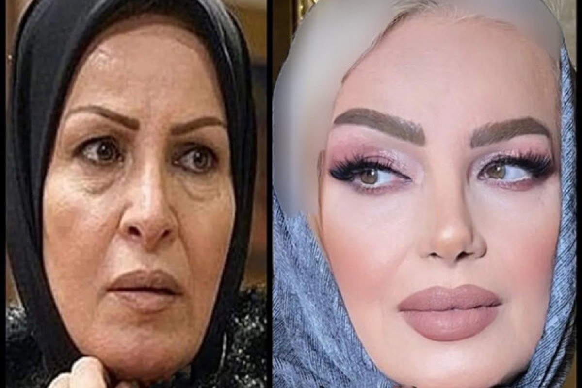 تغییر چهره هما خاکپاش بازیگر بعد از مدتها دوری از سینما