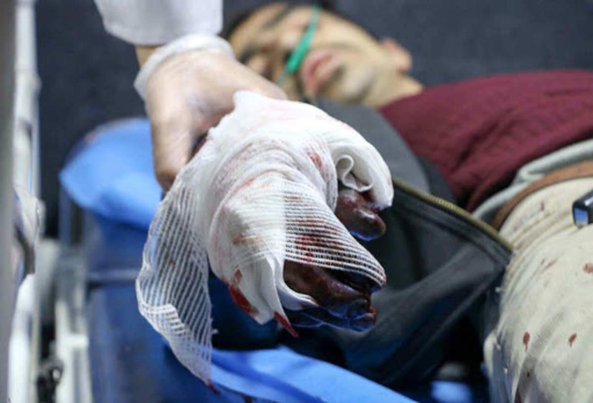 حوادث چهارشنبه سوری همدان